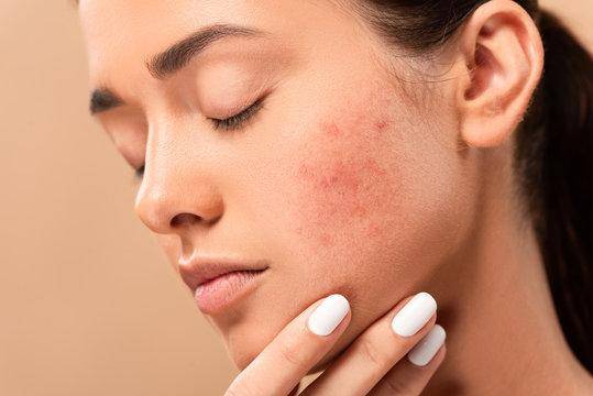10 Rekomendasi Serum Lokal yang Cocok untuk Kulit Berjerawat
