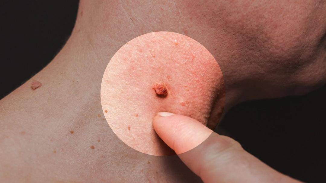 https://www.klikdokter.com/