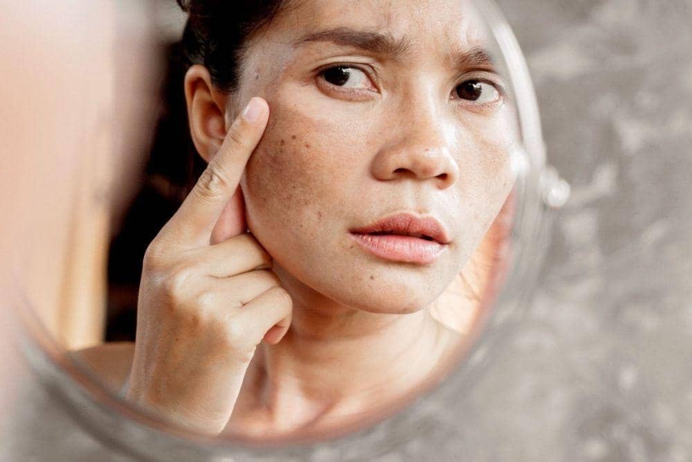 Macam-macam Diet untuk Berbagai Jenis Kulit/ webmd.com