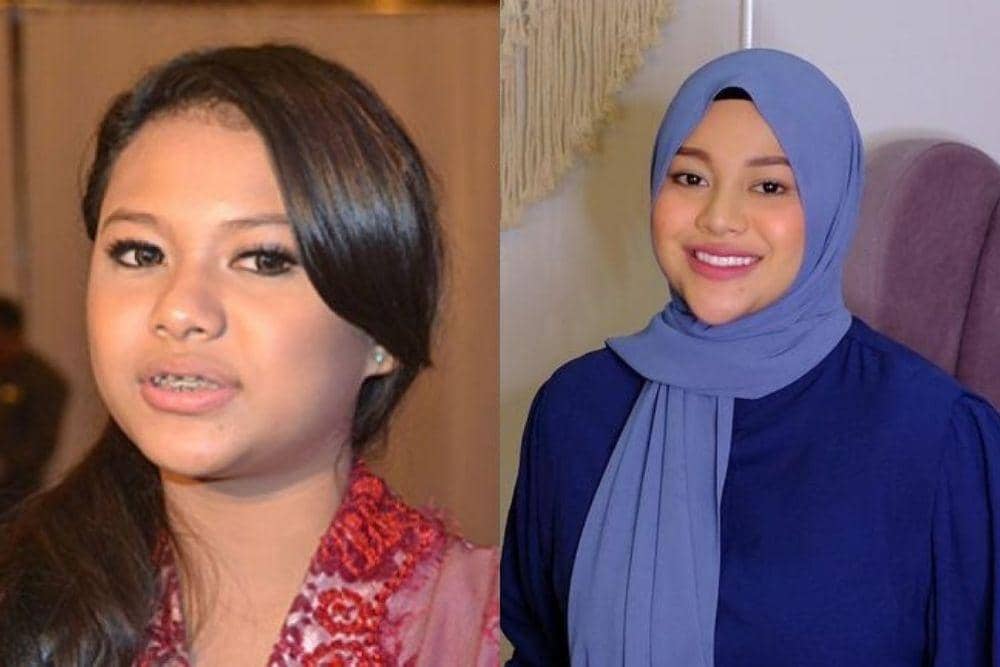 doc.internet, instagram.com/aurelie.hermansyah