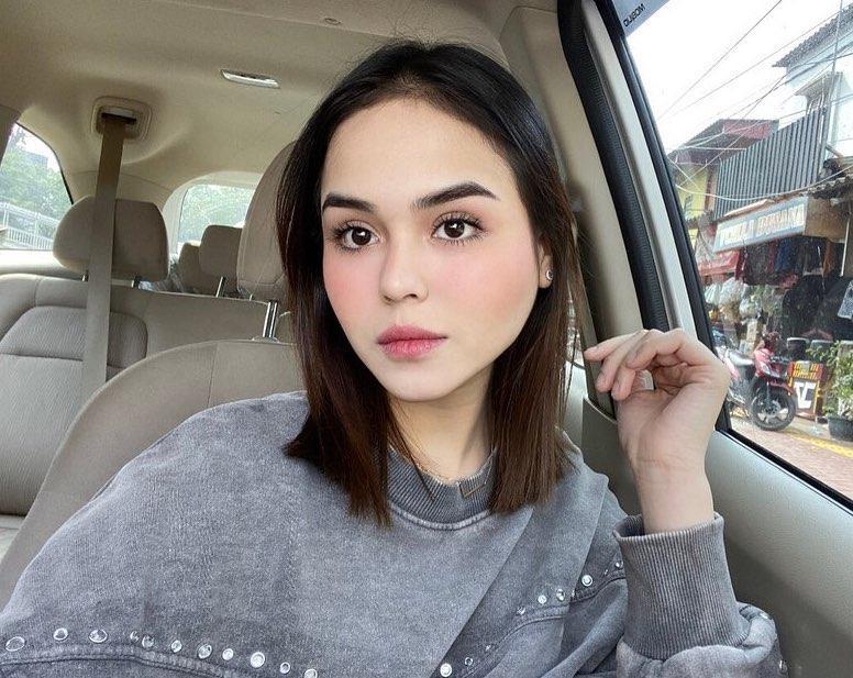 Meninggal Dunia, 4 Derita yang Dialami Laura Anna Akibat Kecelakaan