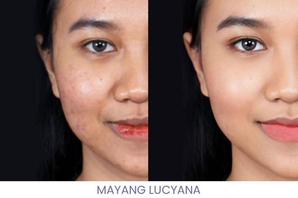 instagram.com/dermaprosf