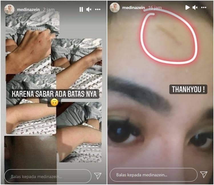 Instagram.com/medinazein