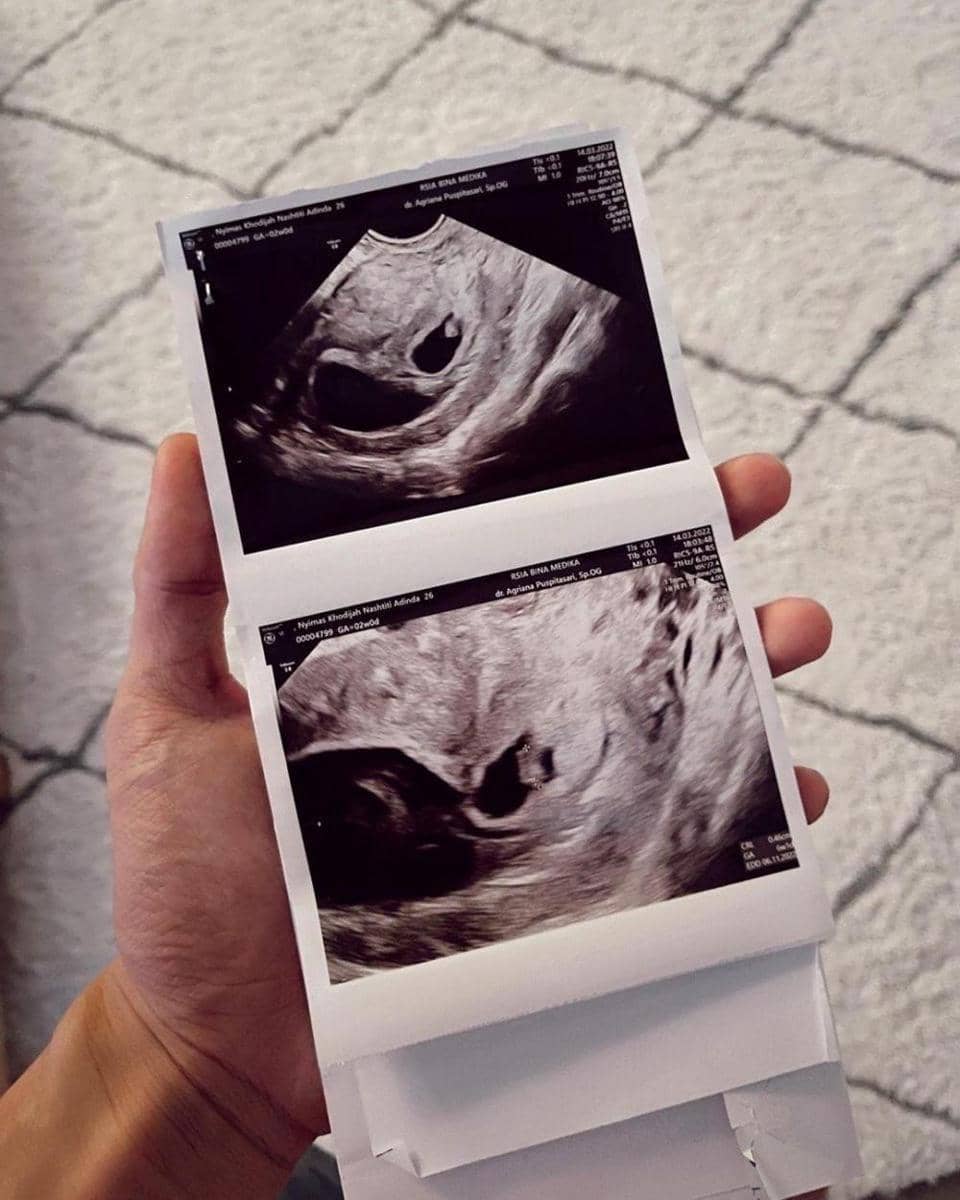 Instagram.com/dindahw