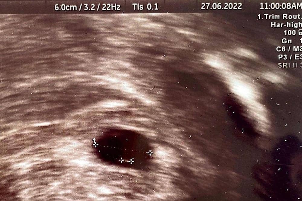 Instagram.com/annisayudhoyono