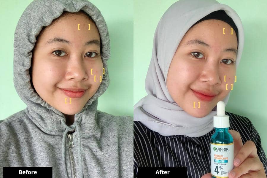 Popbela.com/Asri Muspita Sari