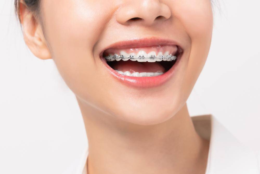 reopelleorthodontics.com