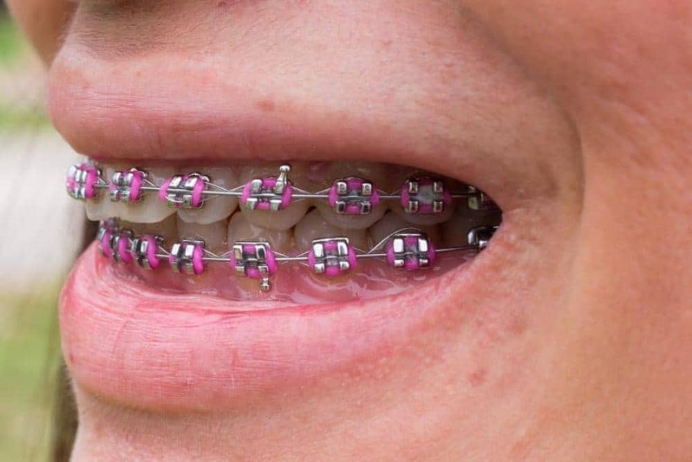 australinddental.com