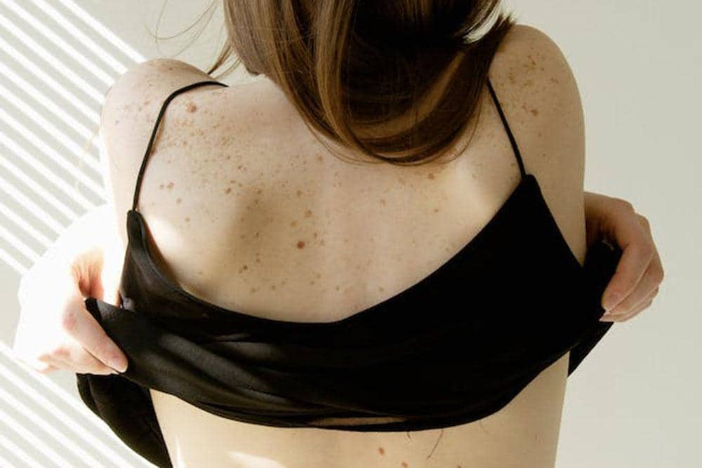 Pexels/Anna Nekrashevich