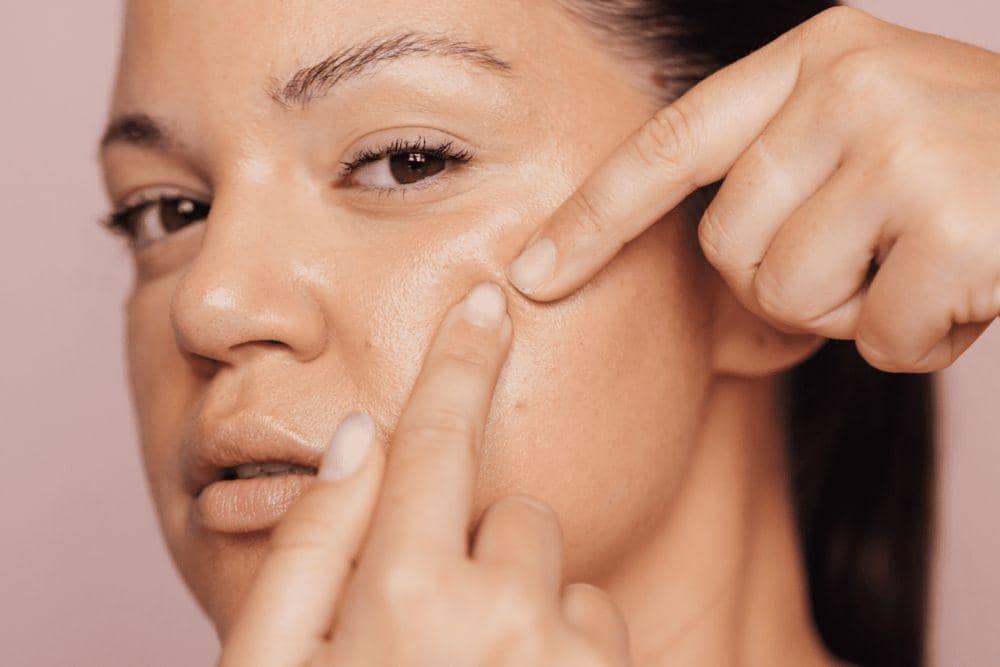 byrdie.com/Rekomendasi Obat Totol Jerawat Mendem