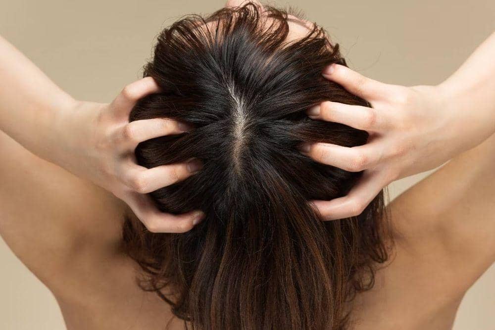 healthshots.com/Minyak Rambut untuk Rambut Rontok