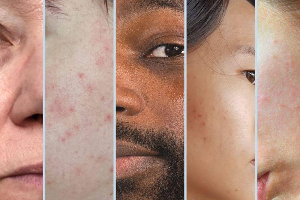 noie.com/Tips Agar Skincare Bekerja Maksimal