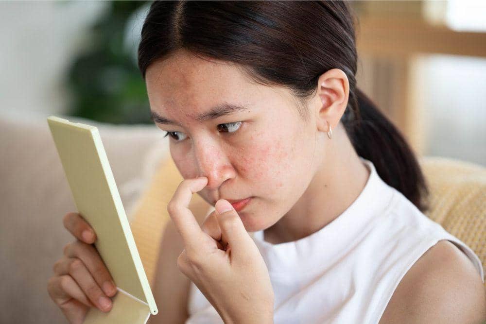 realsimple.com/Ciri Jerawat Karena Tidak Cocok Skincare