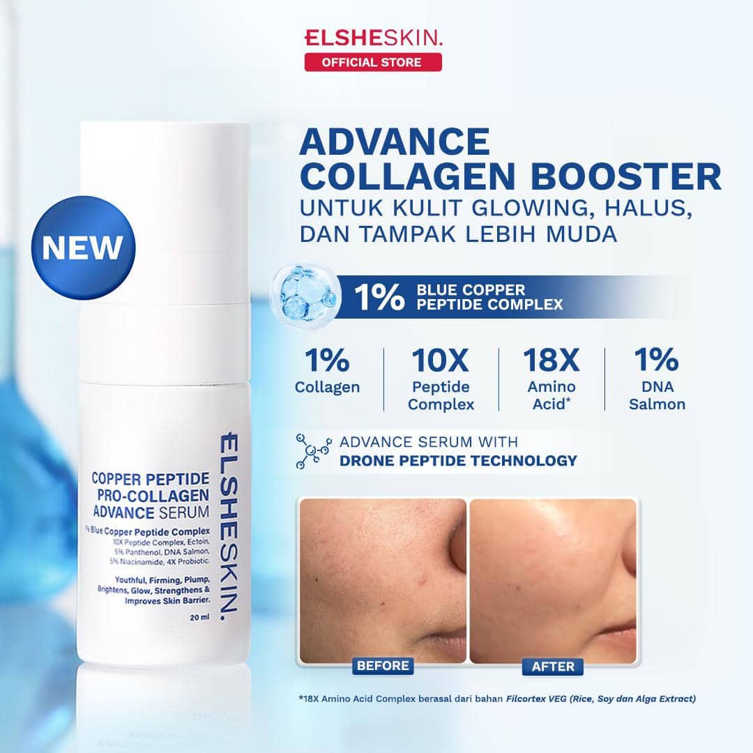 Popbela.com/ELSHESKIN