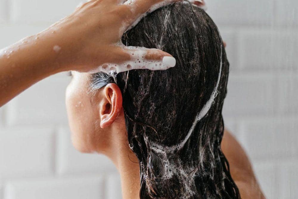 Cara mengatasi ketombe basah