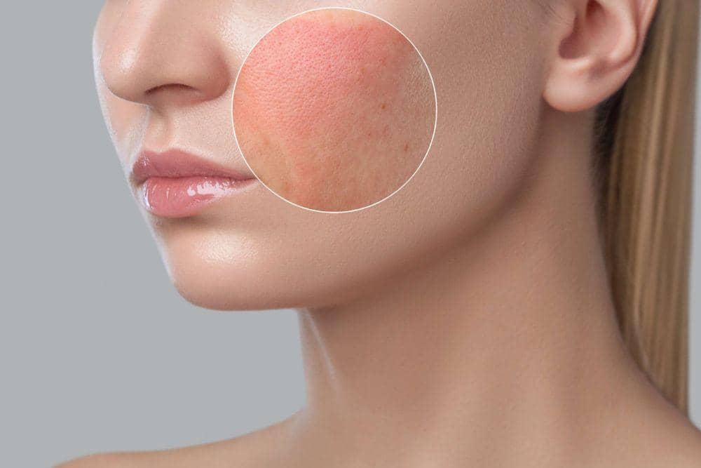 drhmliewskinclinic.com.sg