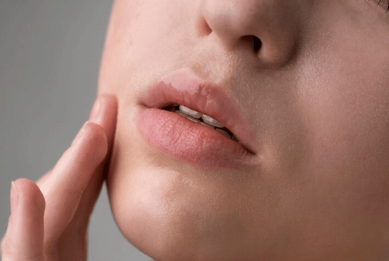 Mengapa Warna Bibir Bisa Menjadi Lebih Gelap? Ini Penjelasannya