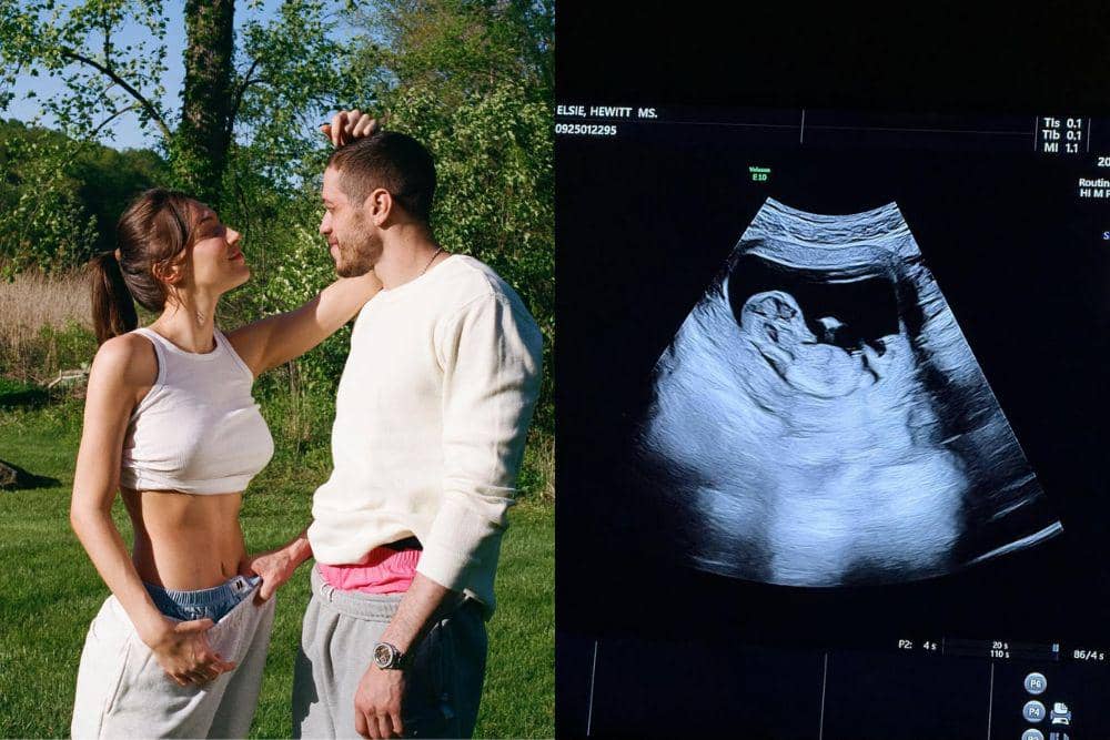 Pete Davidson dan Elsie Hewitt Umumkan Hamil Anak Pertama