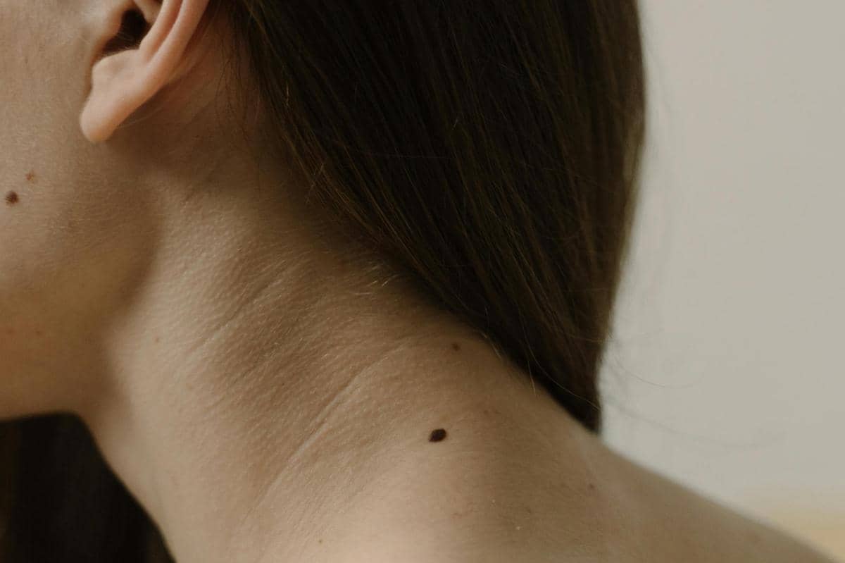 arti letak tanda lahir menurut primbon jawa