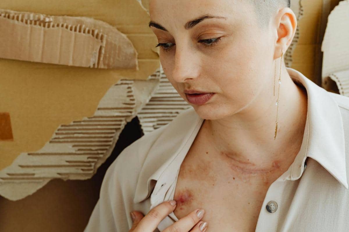 arti letak tanda lahir menurut primbon jawa