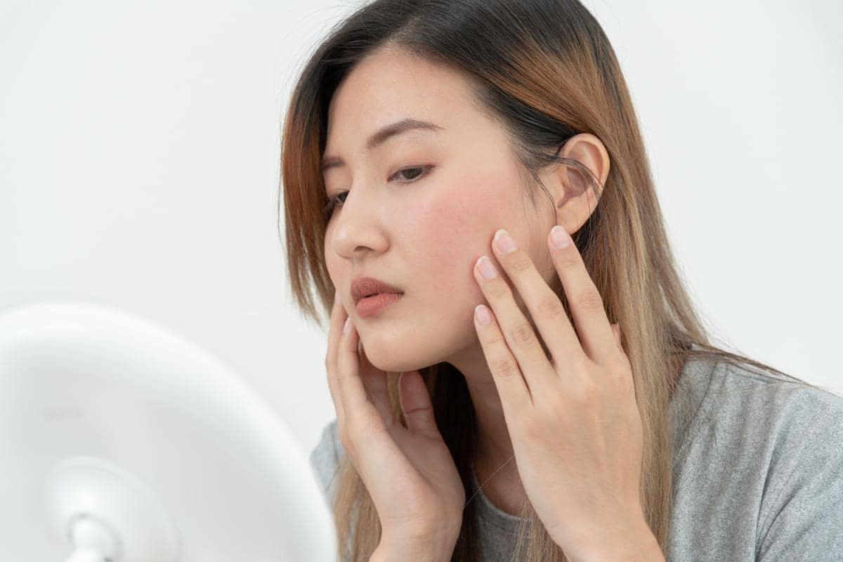 Kulit Kasar di Area Pipi