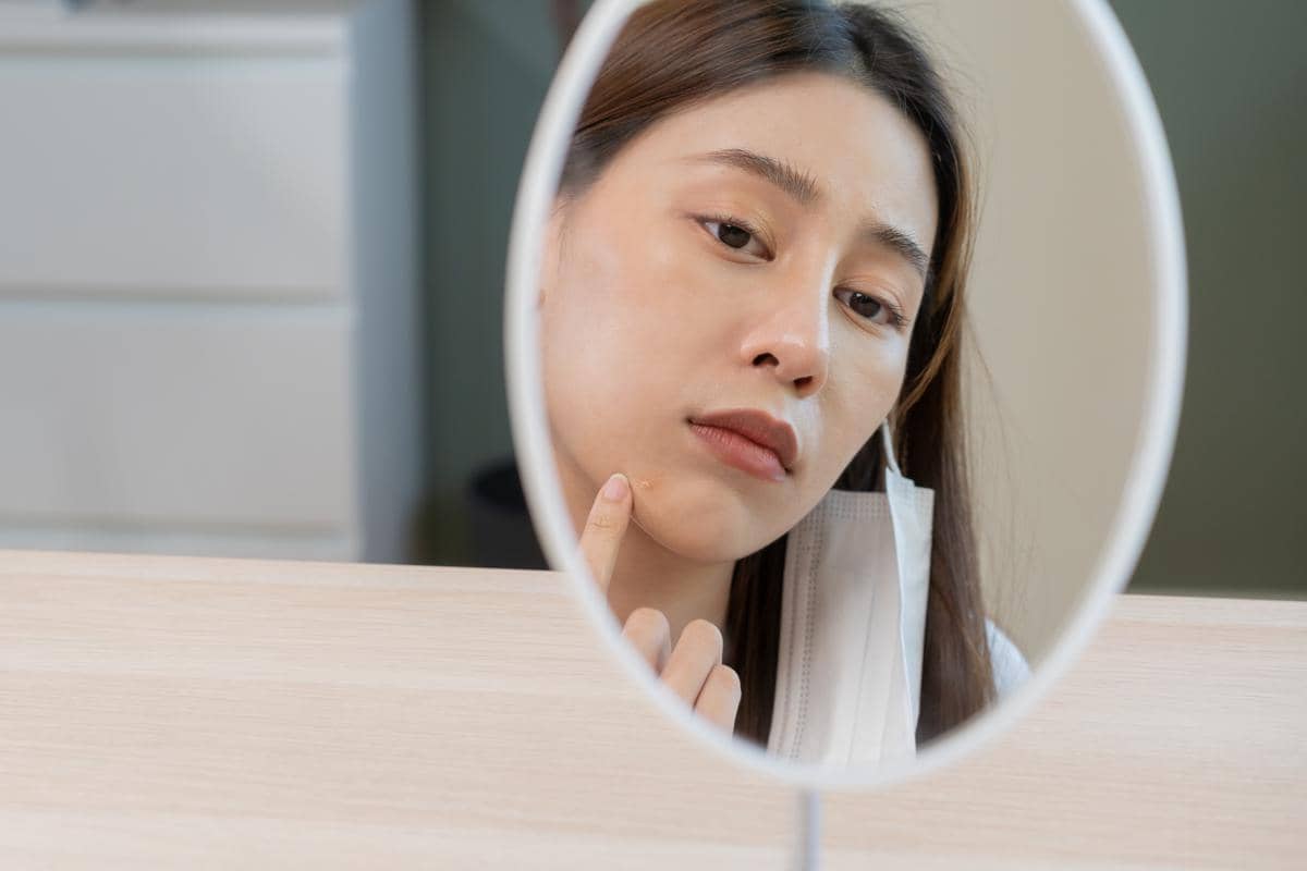 Ilustrasi wajah berkomedo