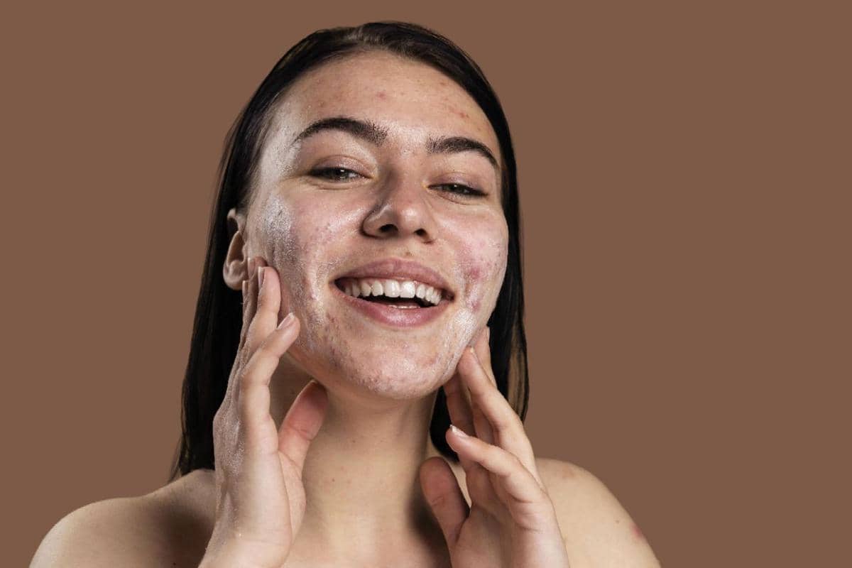 manfaat salicylic acid untuk wajah