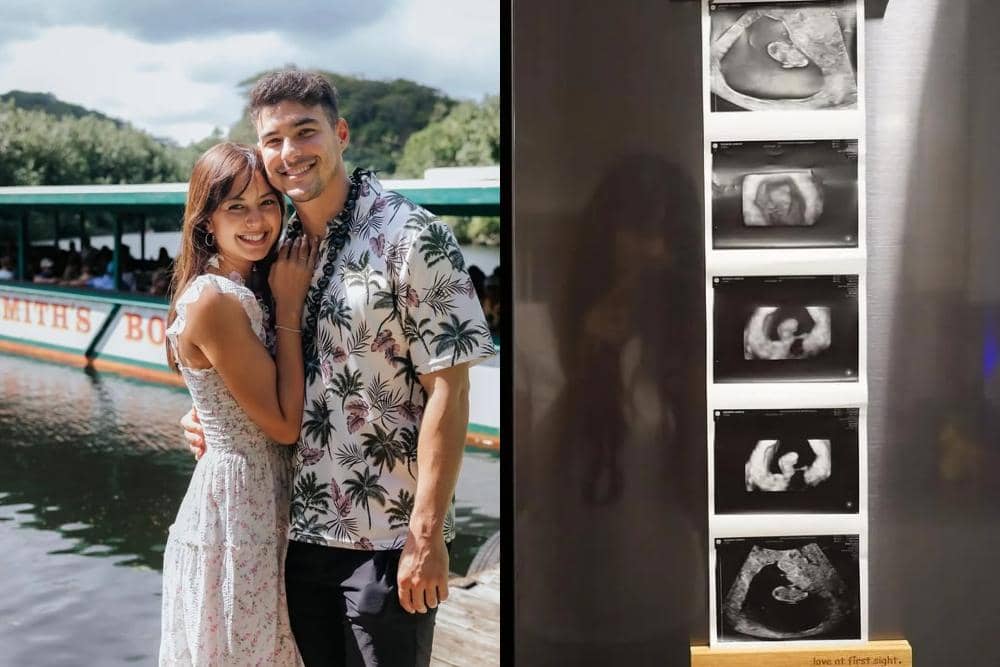 Daftar Artis Indonesia yang Umumkan Kehamilan di Tahun 2025