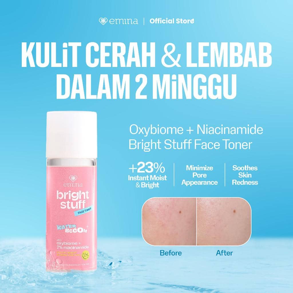 toner yang mengandung niacinamide