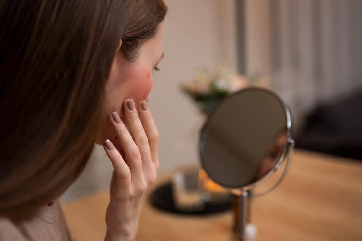 Ilustrasi iritasi pada kulit wajah