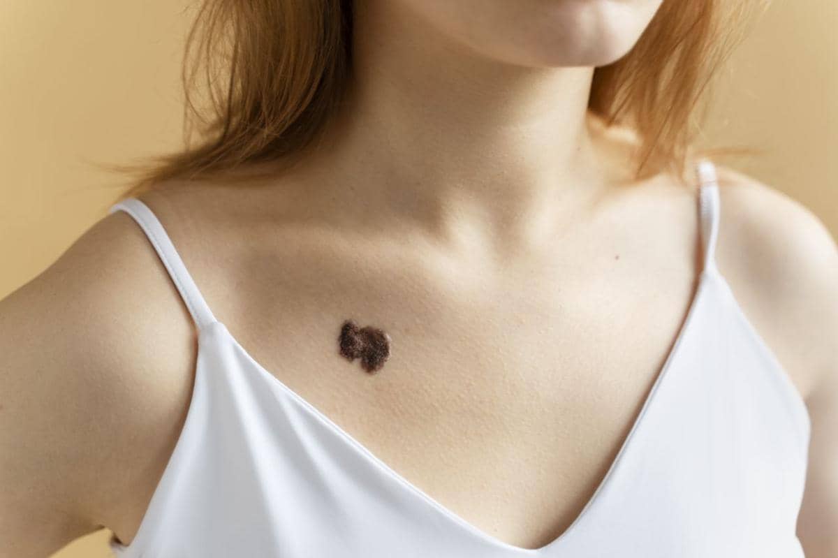 fungsi zinc oxide dalam sunscreen