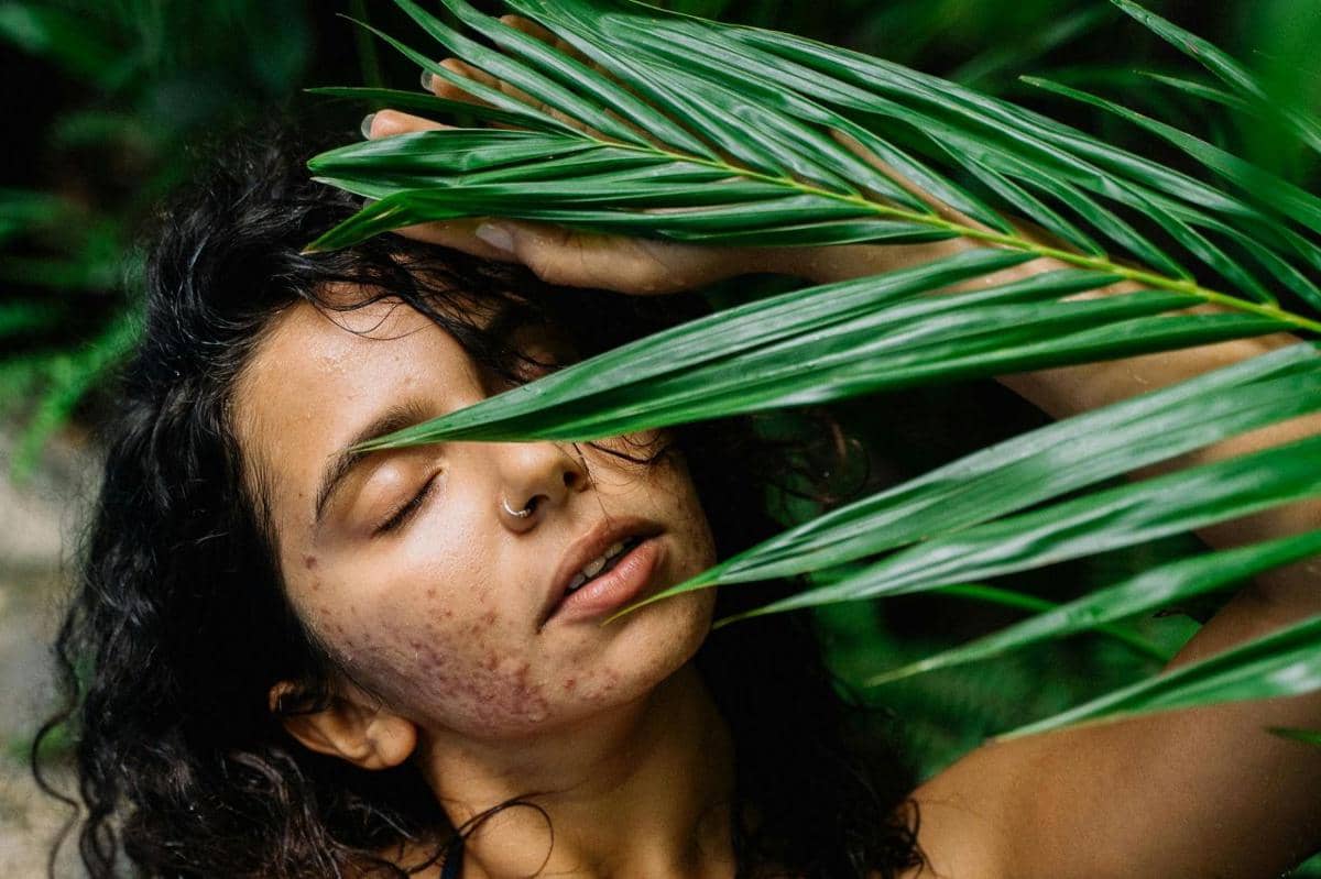 manfaat retinol untuk jerawat