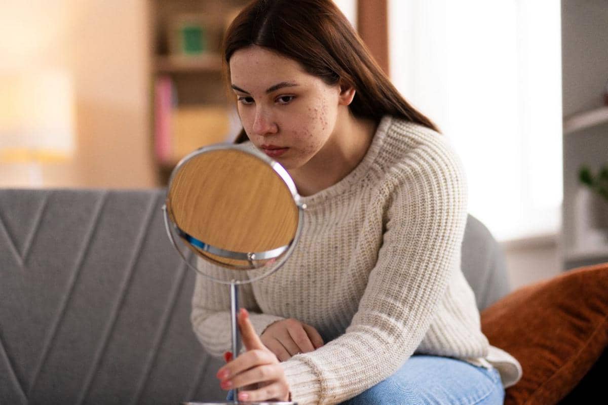 apakah retinol bisa menghilangkan jerawat