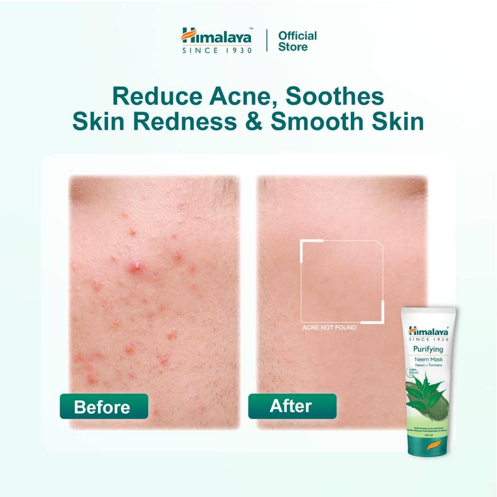 review Himalaya Purifying Neem Mask