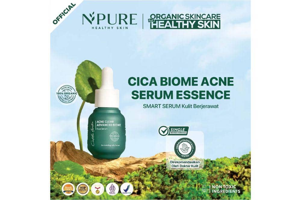 rekomendasi serum untuk kulit berjerawat terbaik 2025