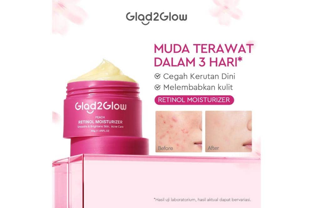 rekomendasi night cream yang mengandung retinol