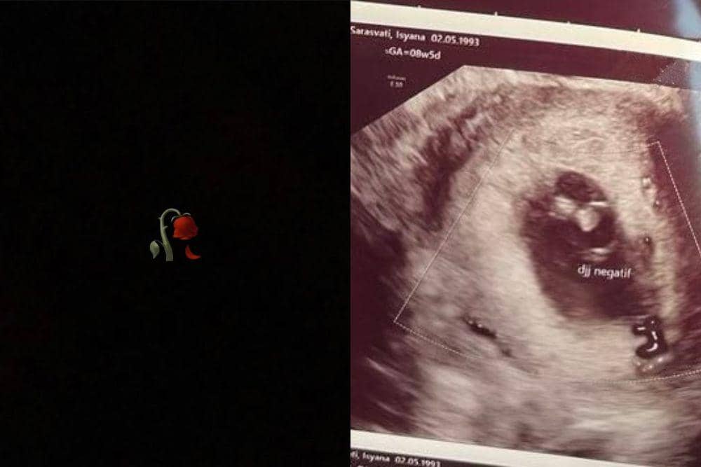 Isyana Sarasvati keguguran