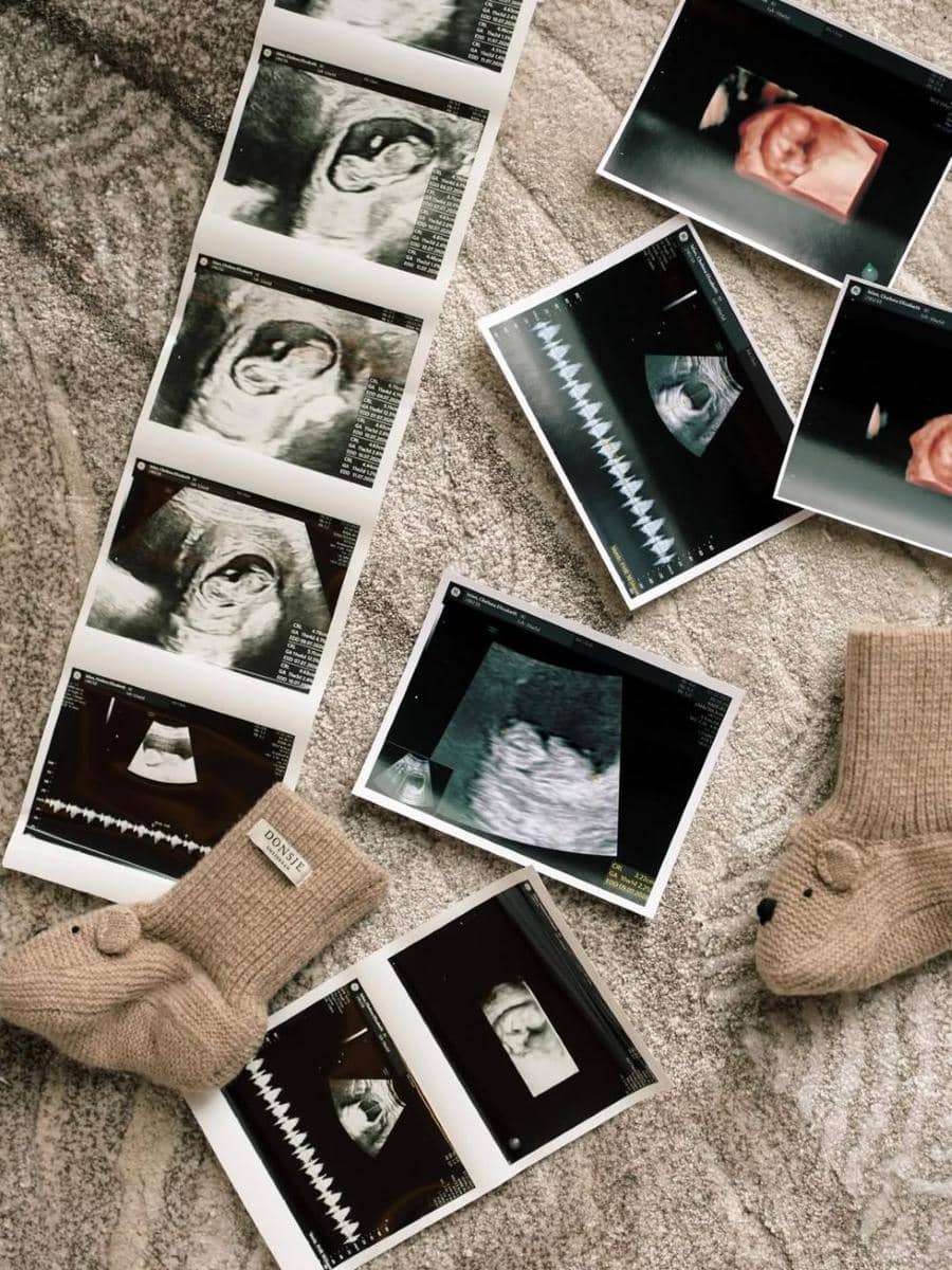 Maternity Shoot Chelsea Islan dan Rob Clinton