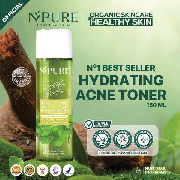 toner untuk kulit berminyak dan berjerawat