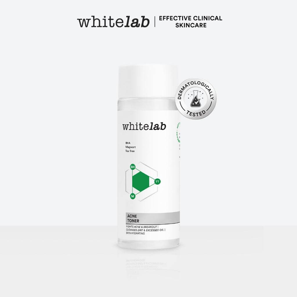 toner untuk kulit berminyak dan berjerawat