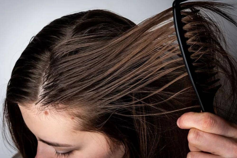 Cara Mengatasi Kulit Kepala Berminyak dan Bau Secara Efektif