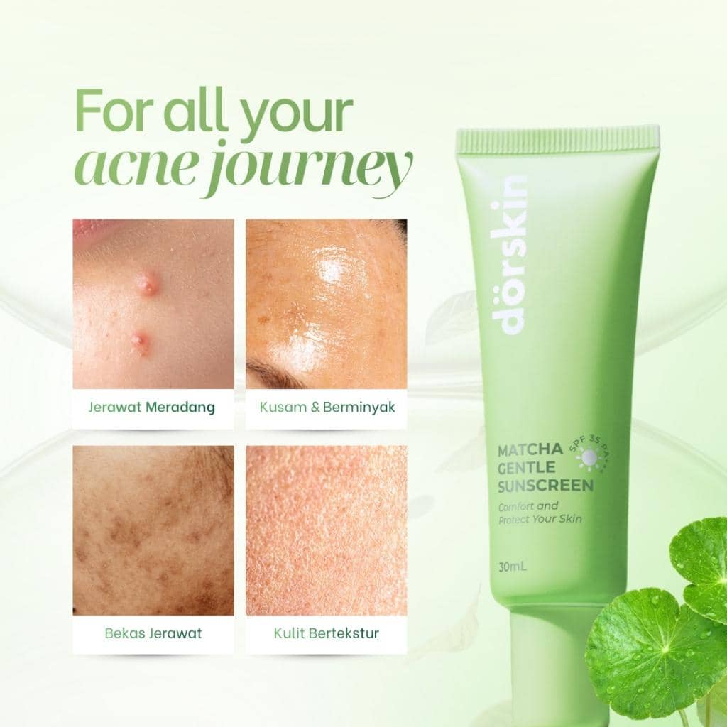 sunscreen untuk kulit berminyak dan sensitif