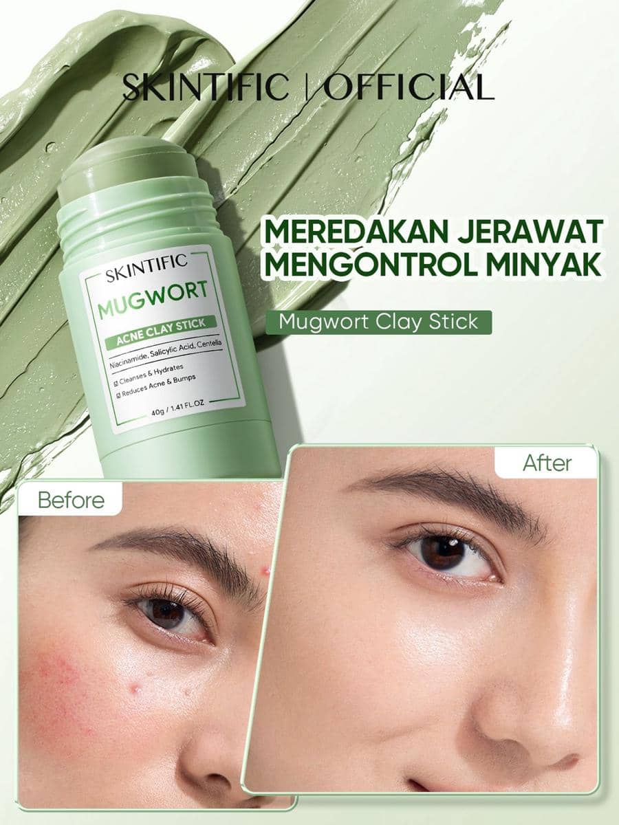 masker untuk kulit berminyak, berjerawat, dan berkomedo