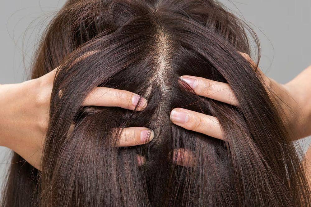 5 Cara Perawatan Rambut Natural di Rumah agar Selalu Sehat