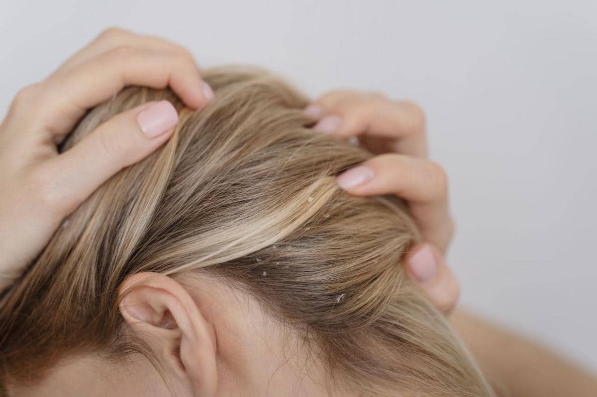 efek samping minyak kemiri untuk rambut