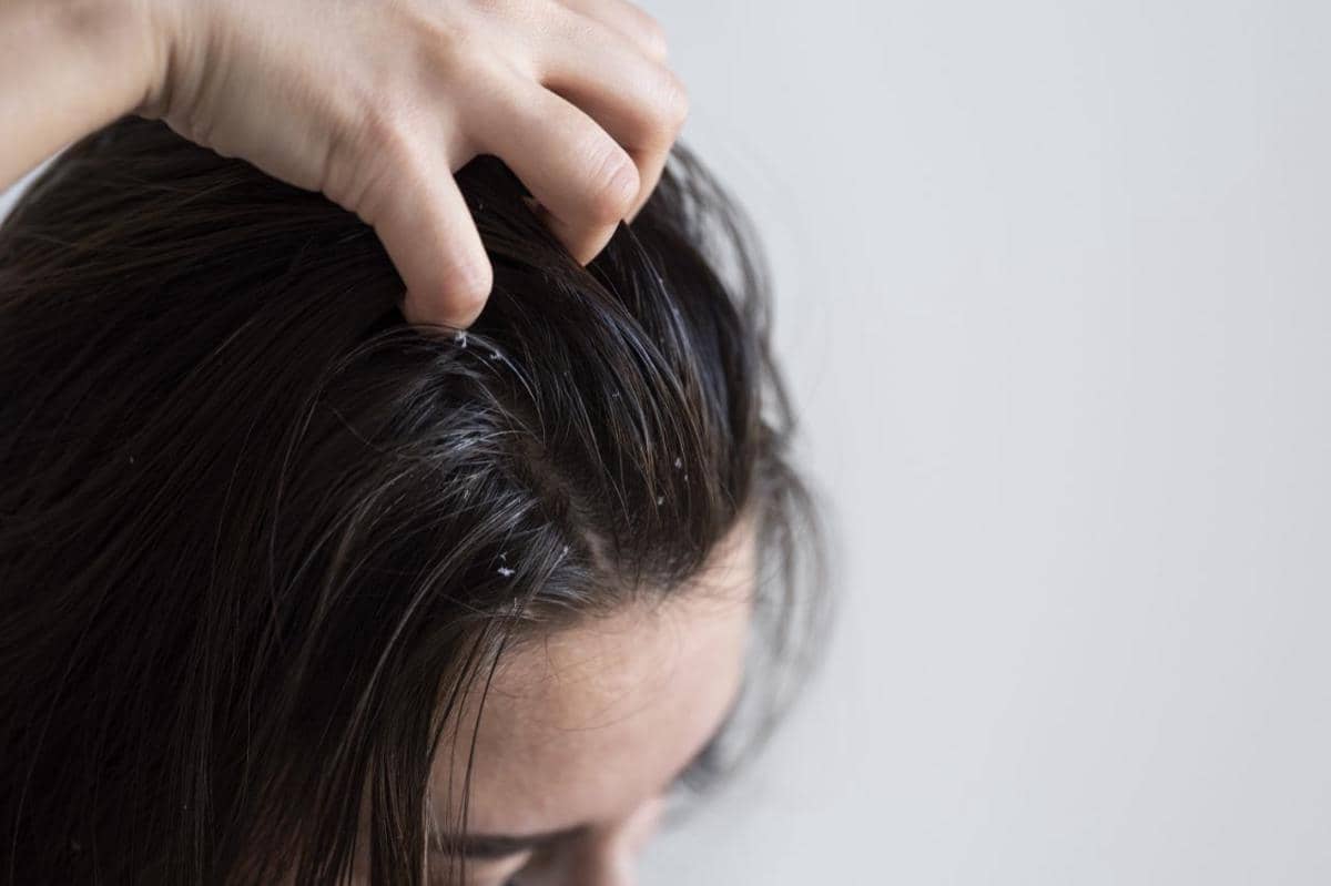 efek samping minyak kelapa untuk rambut 