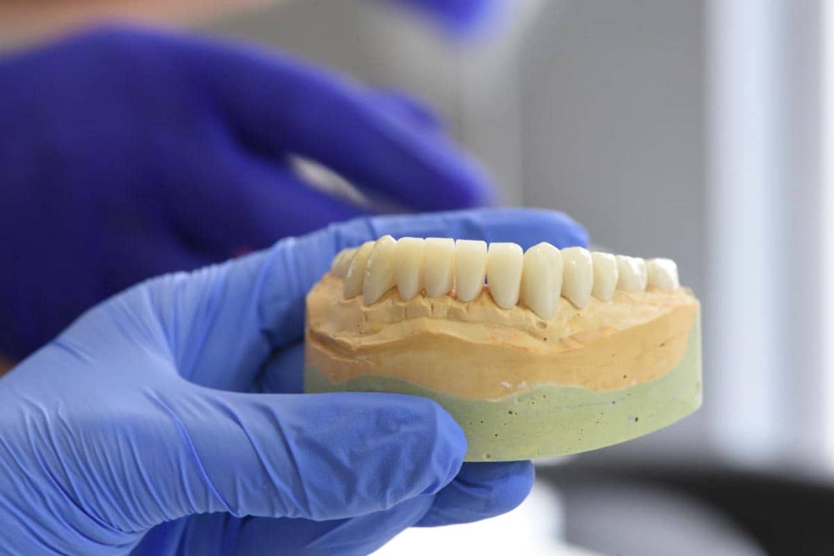 Apa itu zirconia crown