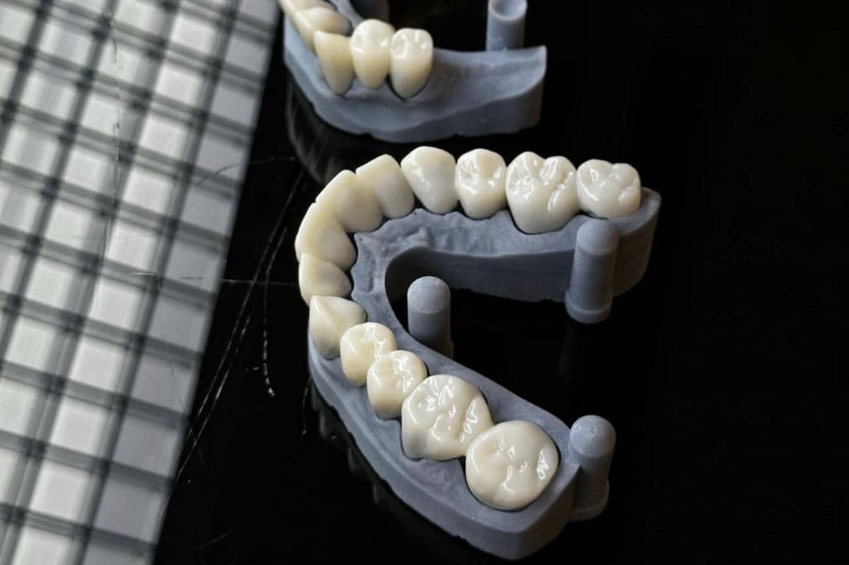 Apa itu zirconia crown