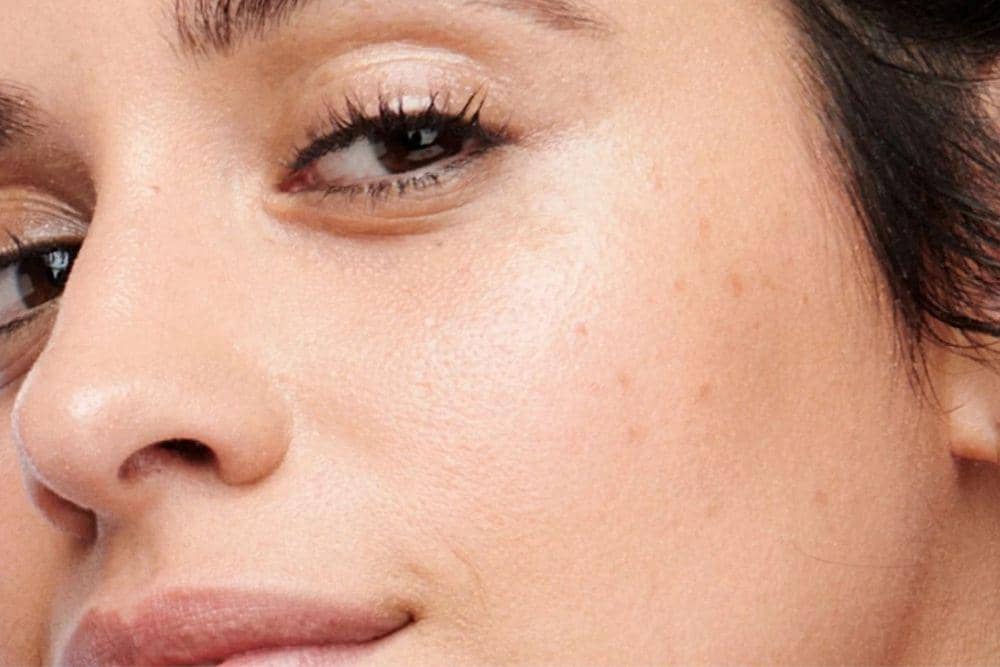 5 Kesalahan Merawat Flek Hitam yang Justru Memperparah Kondisi Kulit