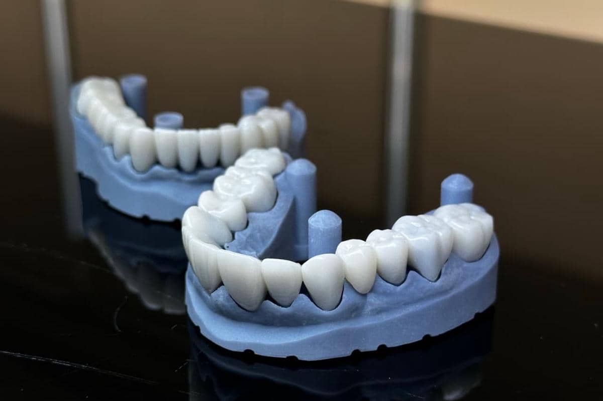 Apa Itu Zirconia Crown? Solusi Gigi Kuat dan Tahan Lama